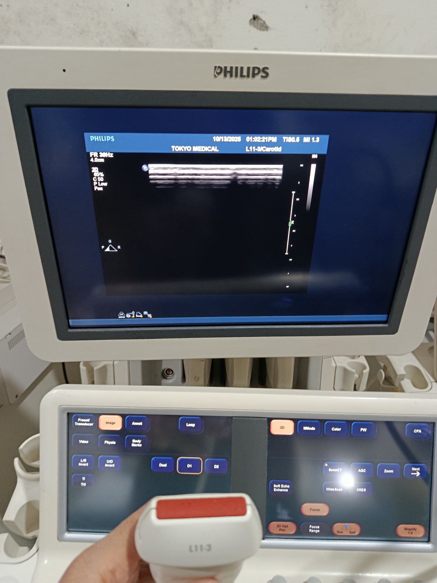 P.. Phillips L11-3 Linear Probe