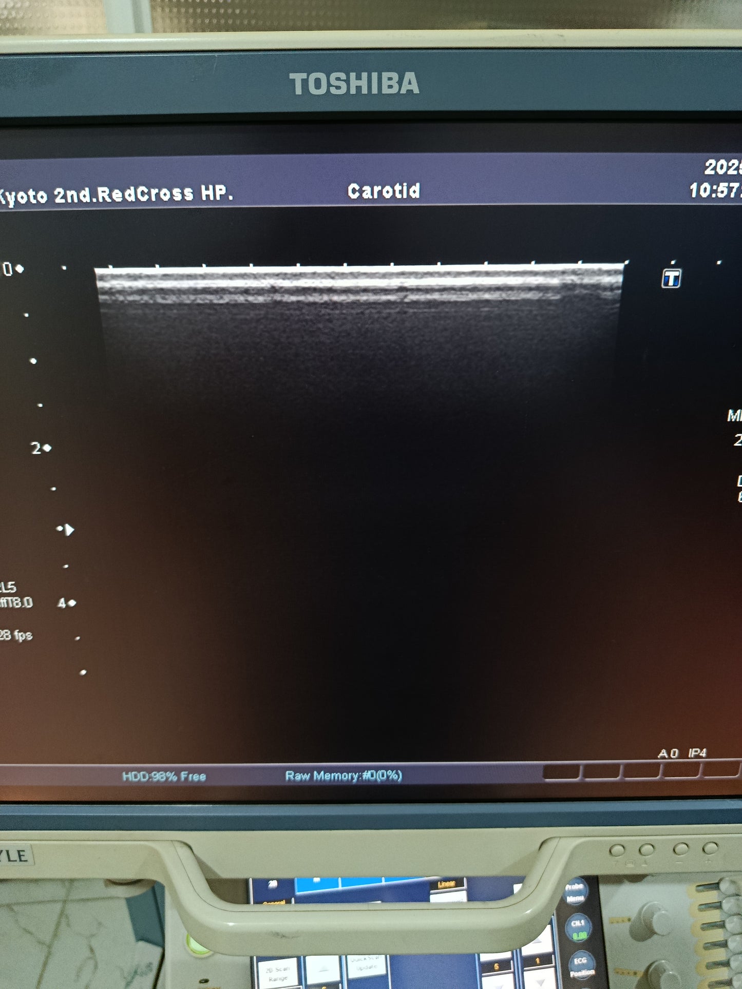 P..Toshiba PLT-805AT Linear Probe