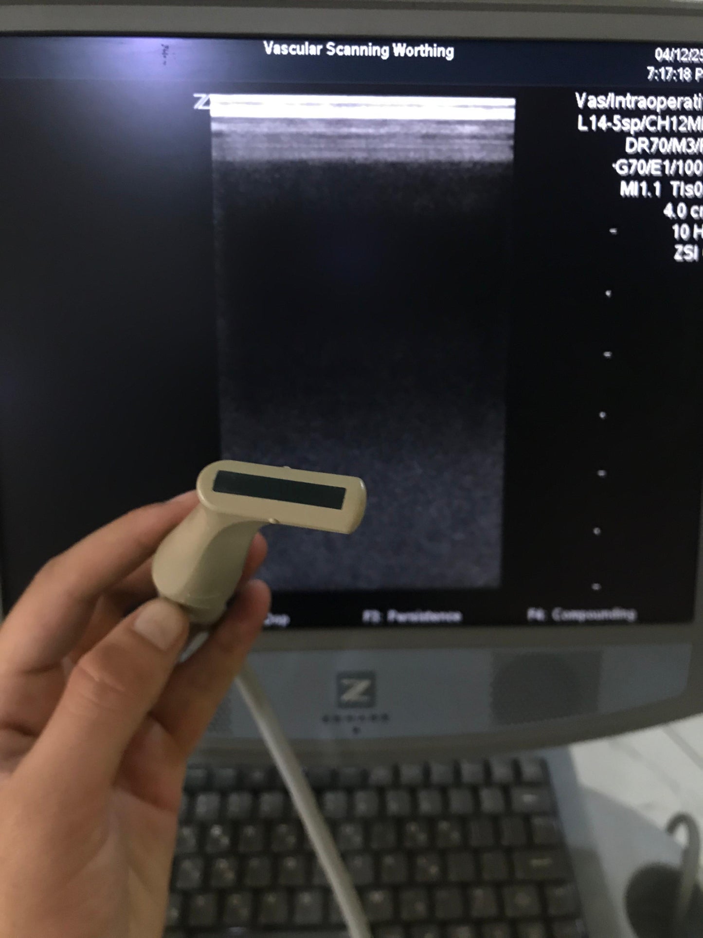 ..Fujifilm L14-5sp linear array probe