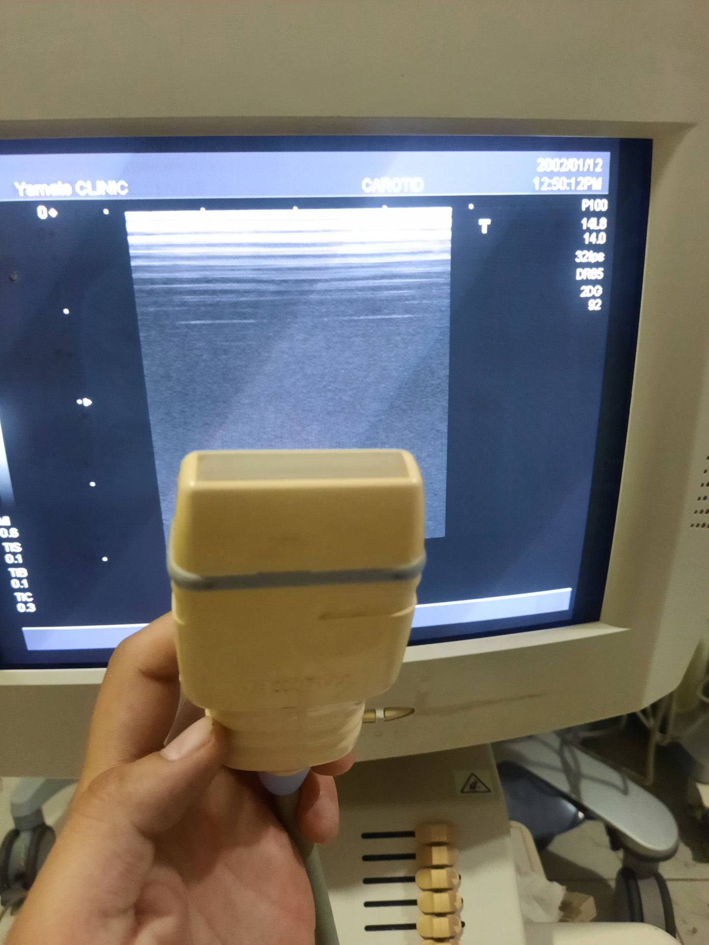 Toshiba PLM-1204AT Linear Probe