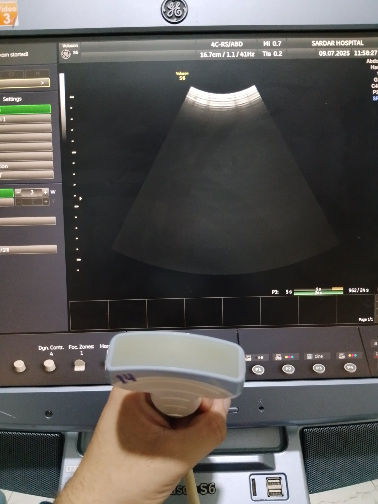 P..4c-Rs convex probe (14)
