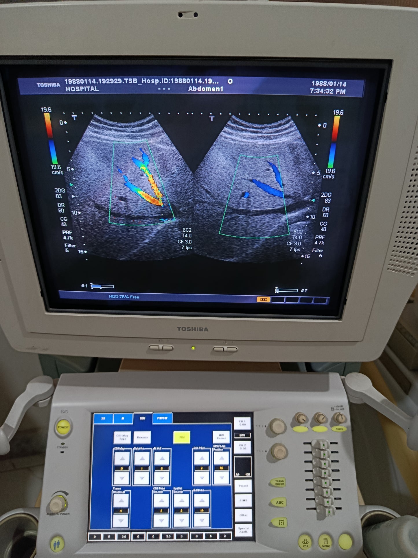 P.. Toshiba PVT-375AT Convex Probe