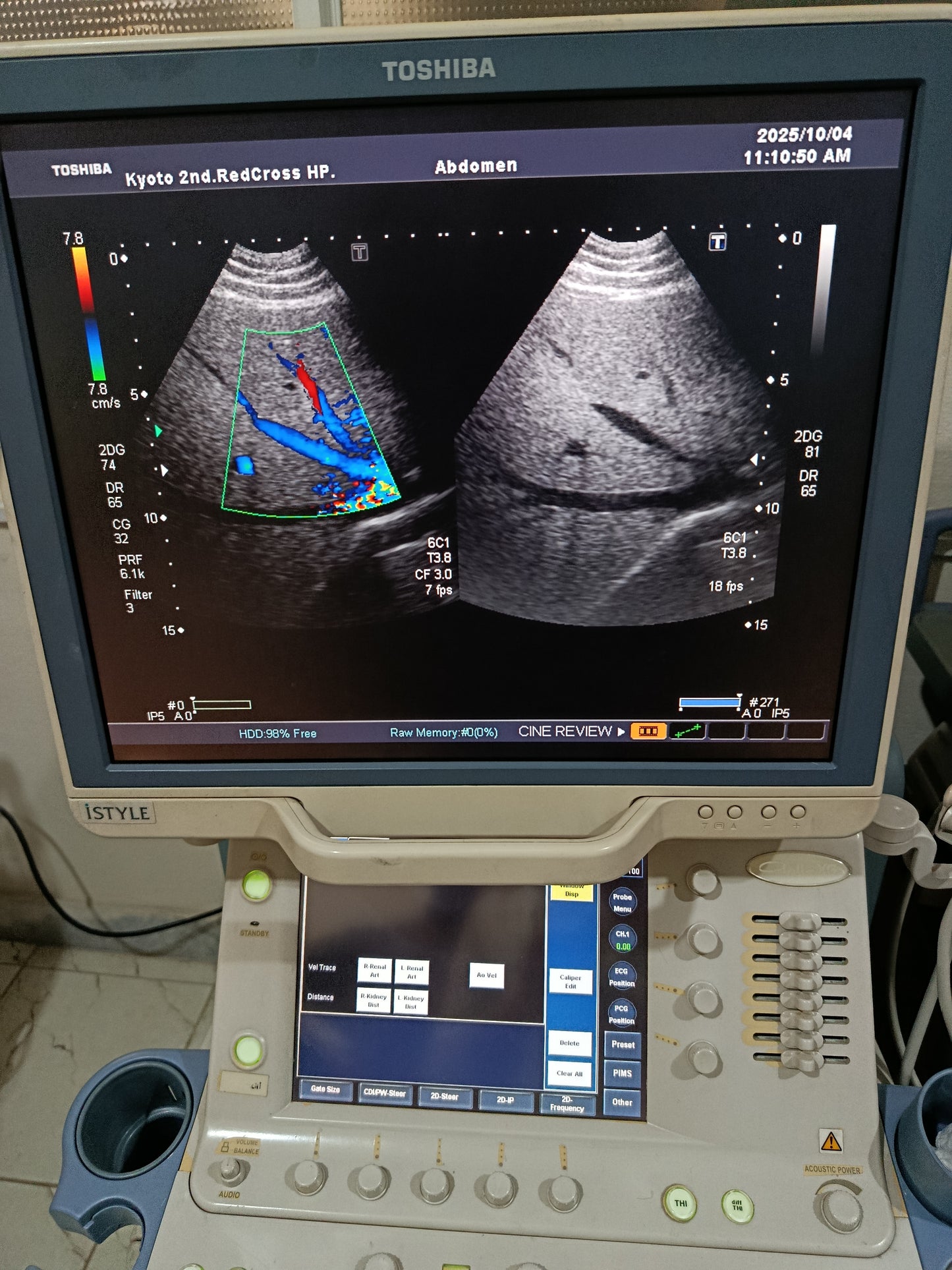 P..Toshiba PVT-382BT Cardiac Probe UC
