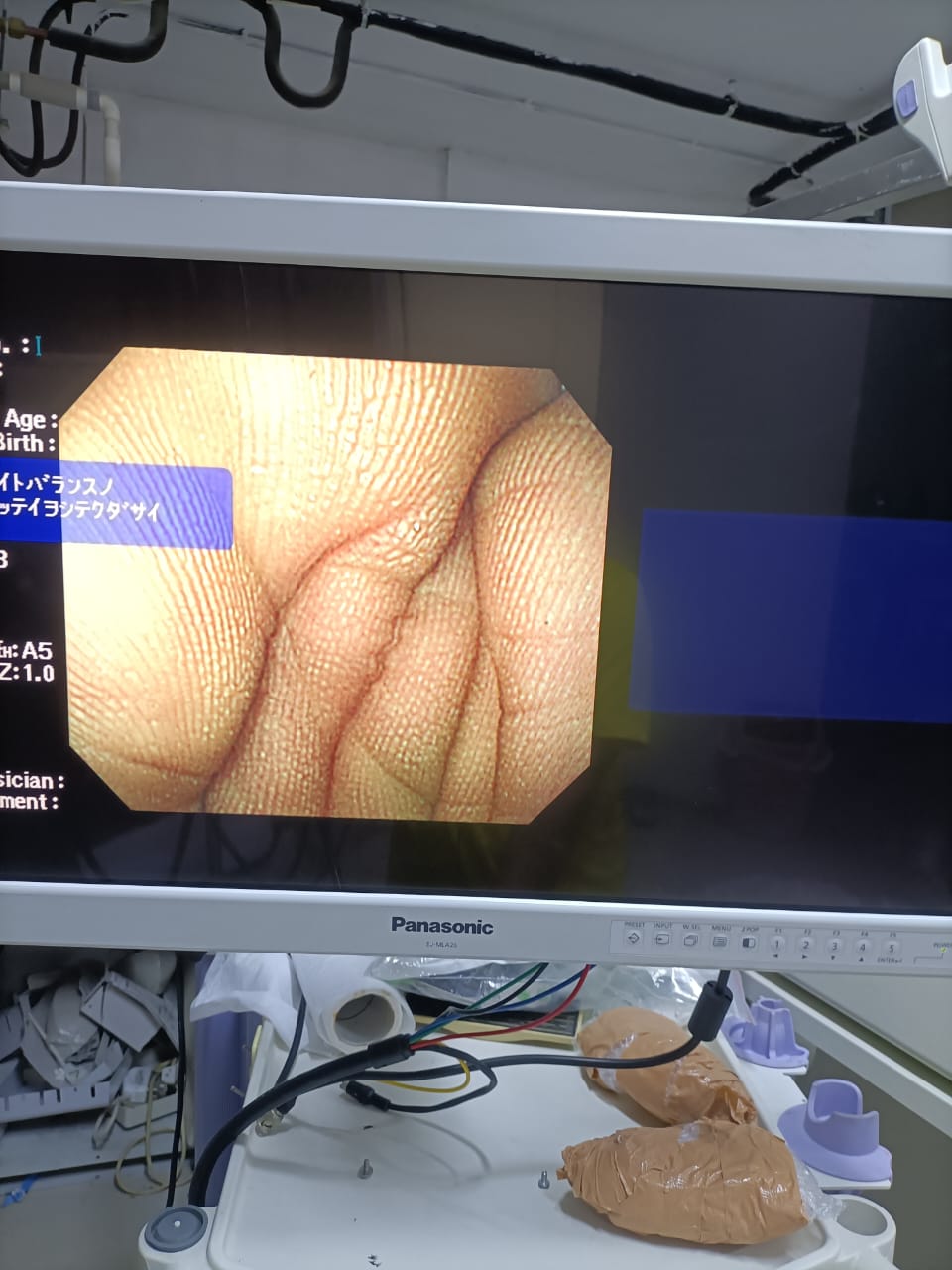 Olympus GIF-Q260 Gastroscope Flexible Video Endoscope DXB
