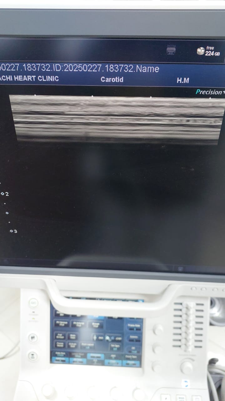 Toshiba Canon PLU-704BT 11L4, Linear array probe Mfg: 07-2018