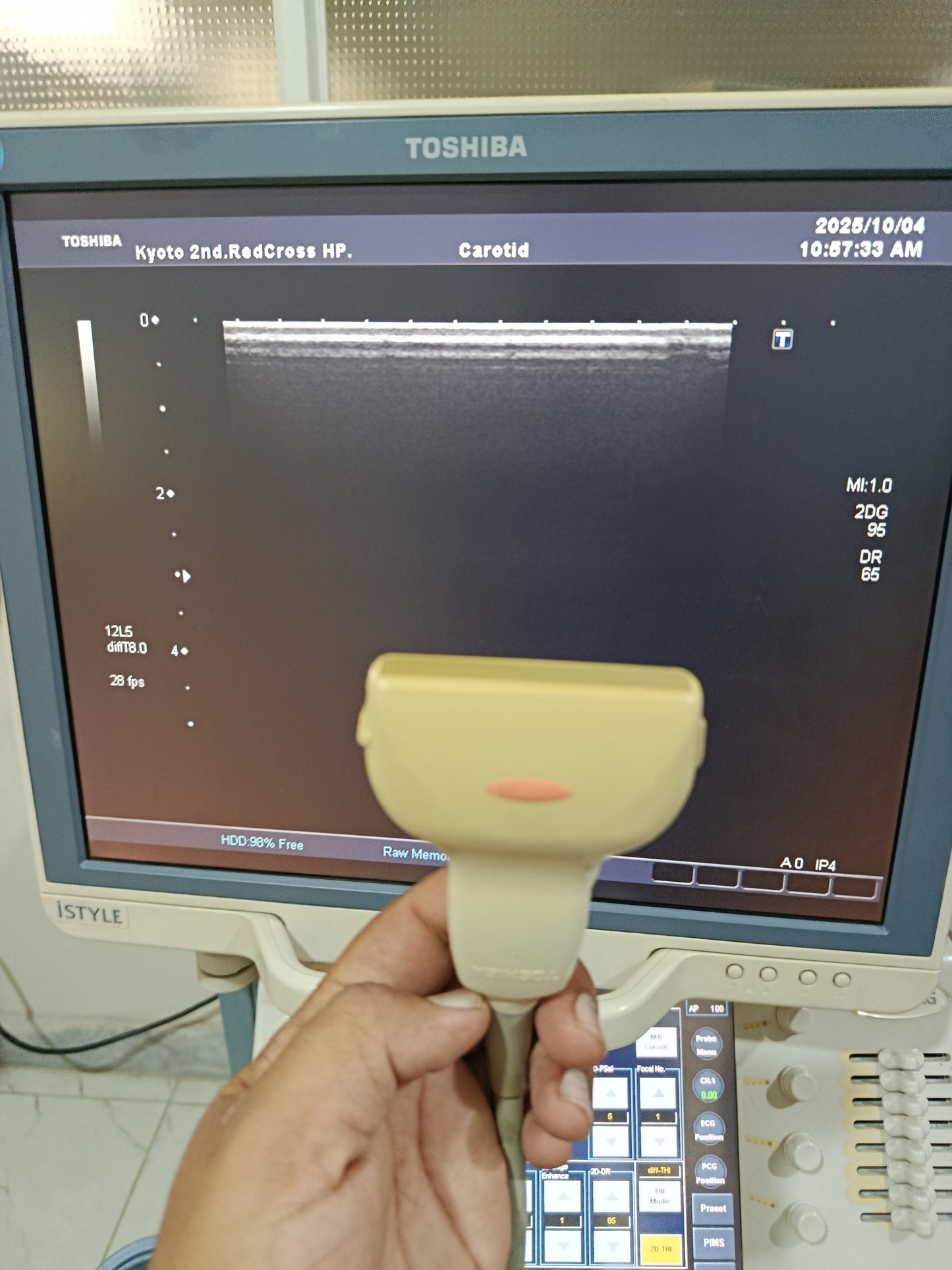 P..Toshiba PLT-805AT Linear Probe