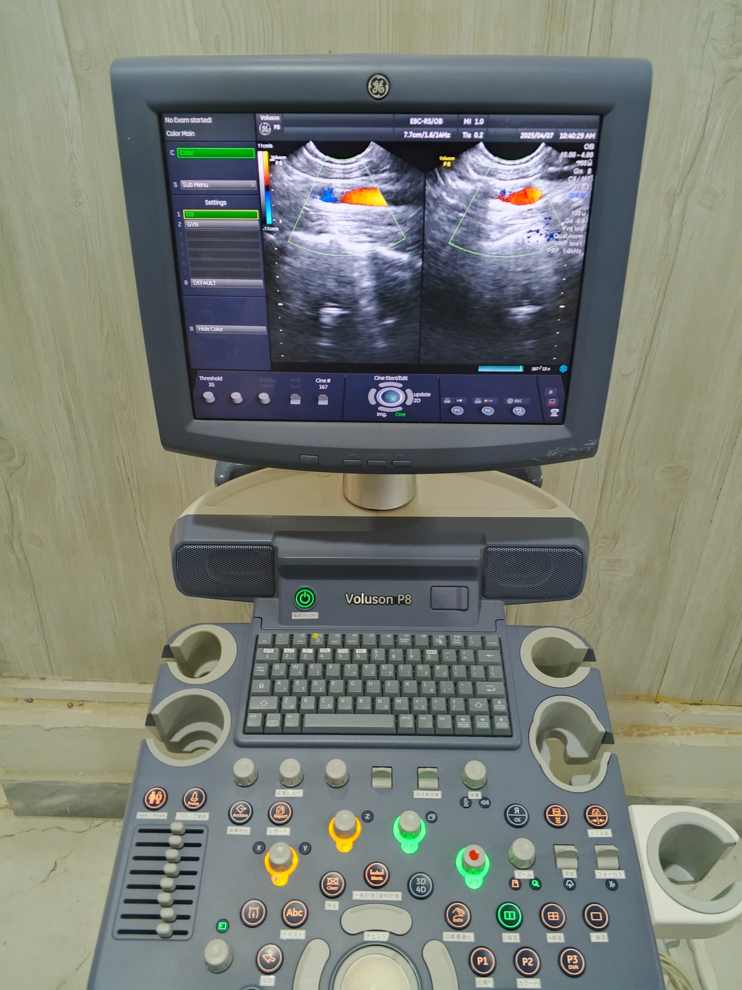 ...GE voluson p8 E8C RS tvs probe