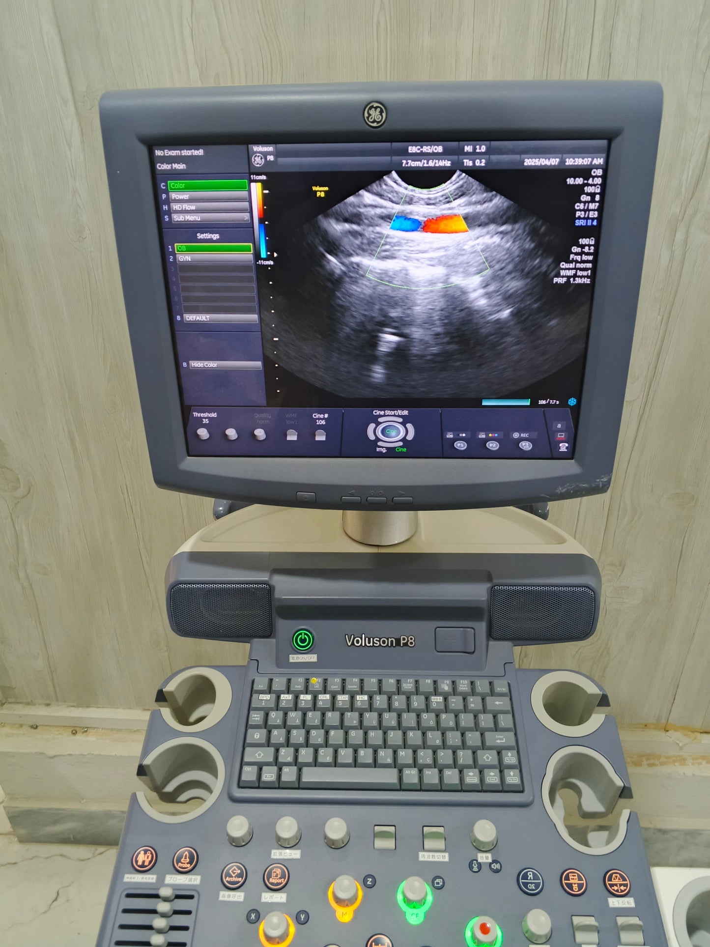 ...GE voluson p8 E8C RS tvs probe