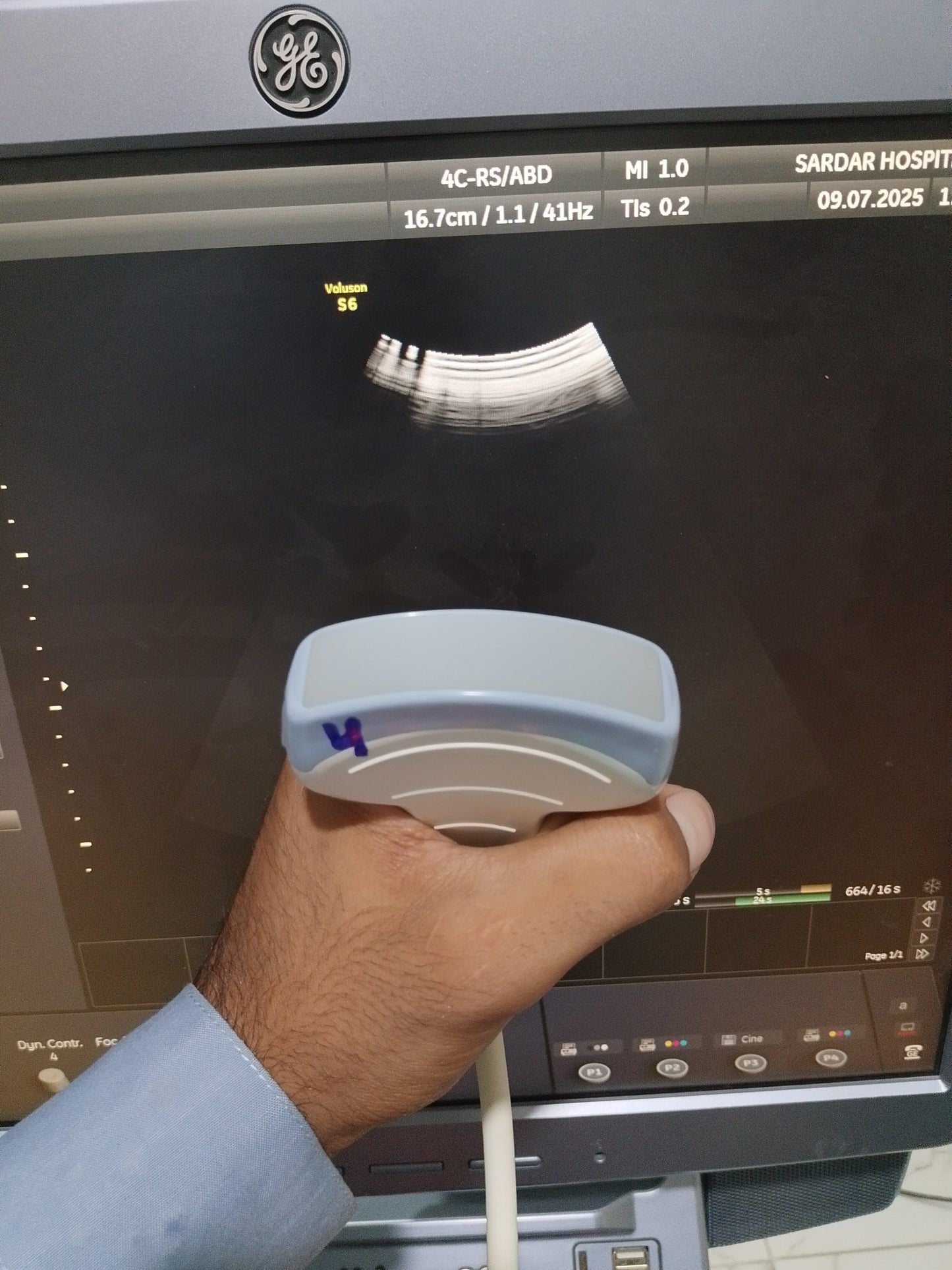 P..4c-RS convex probe (4)