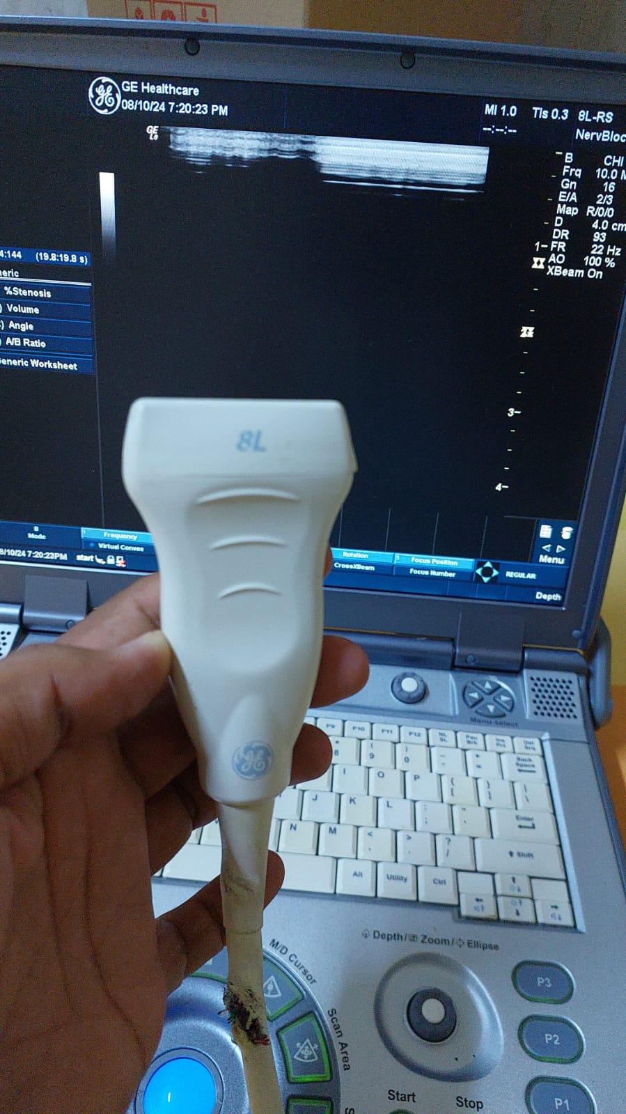..GE 8L-RS linear probe. Cable has cuts, damaged. Checked and Not ok DXB.