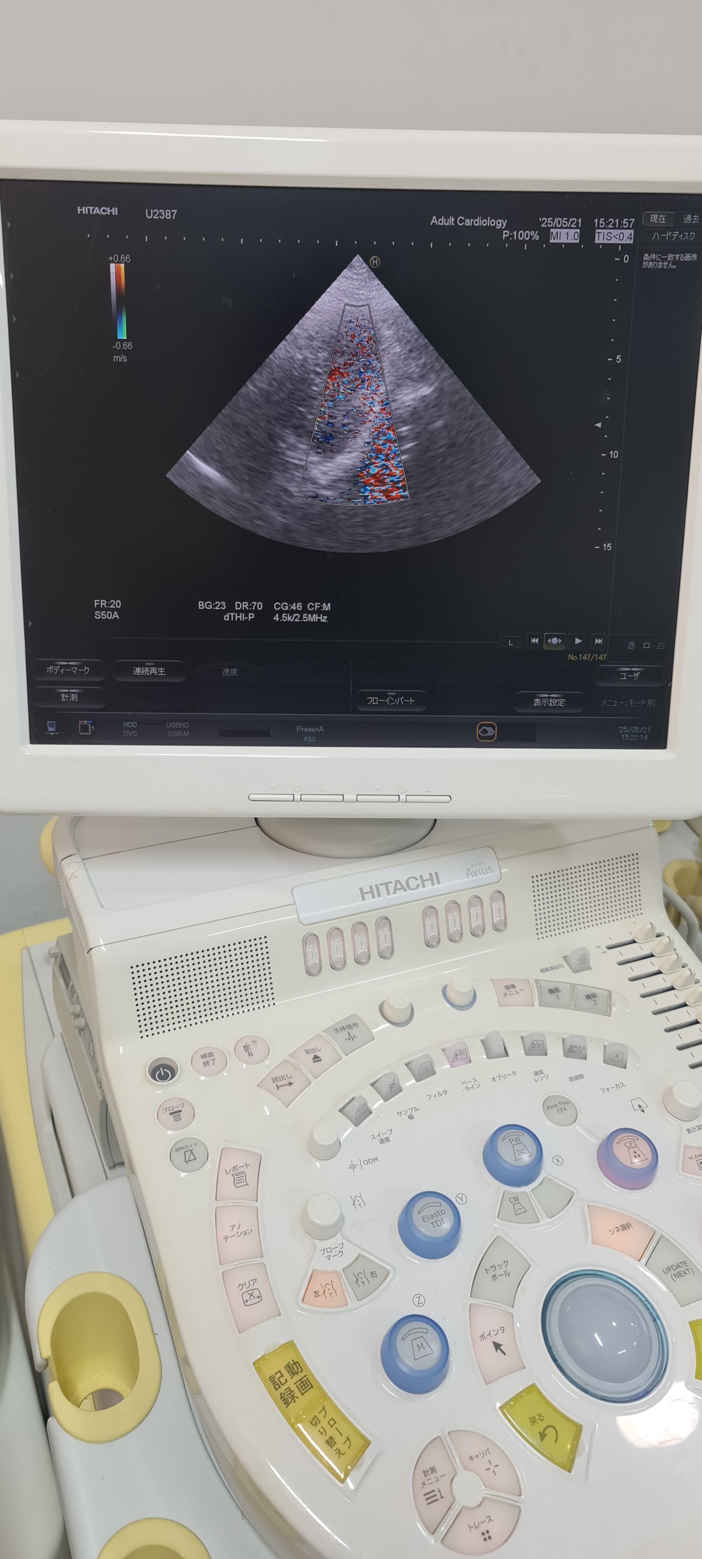 ..Hitachi EUP-S50A cardiac probe Checked DXB