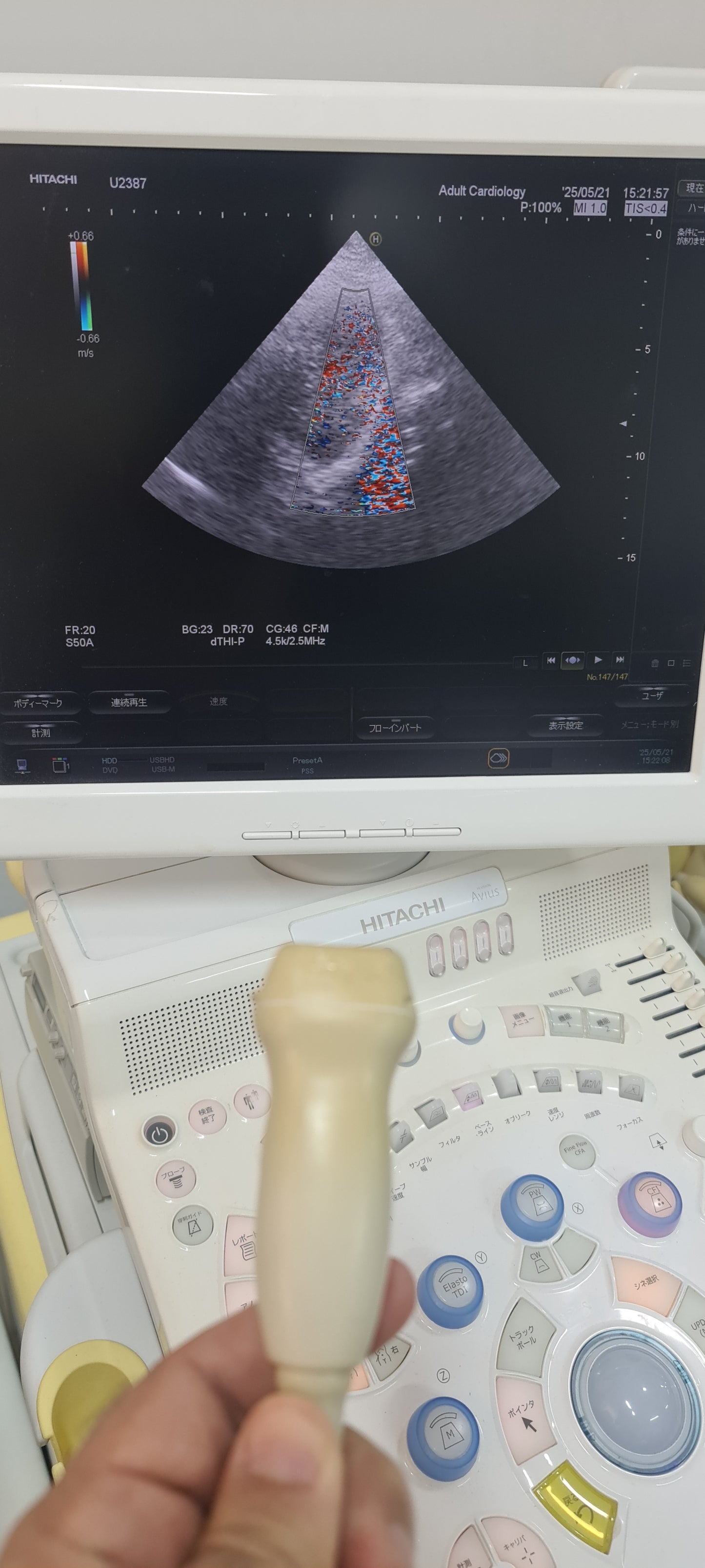 ..Hitachi EUP-S50A cardiac probe Checked DXB