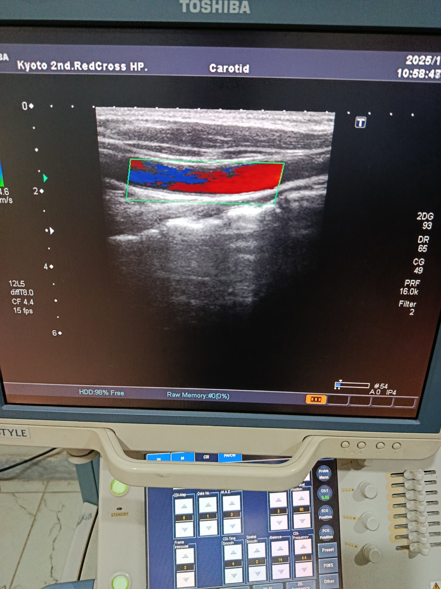 P..Toshiba PLT-805AT Linear Probe