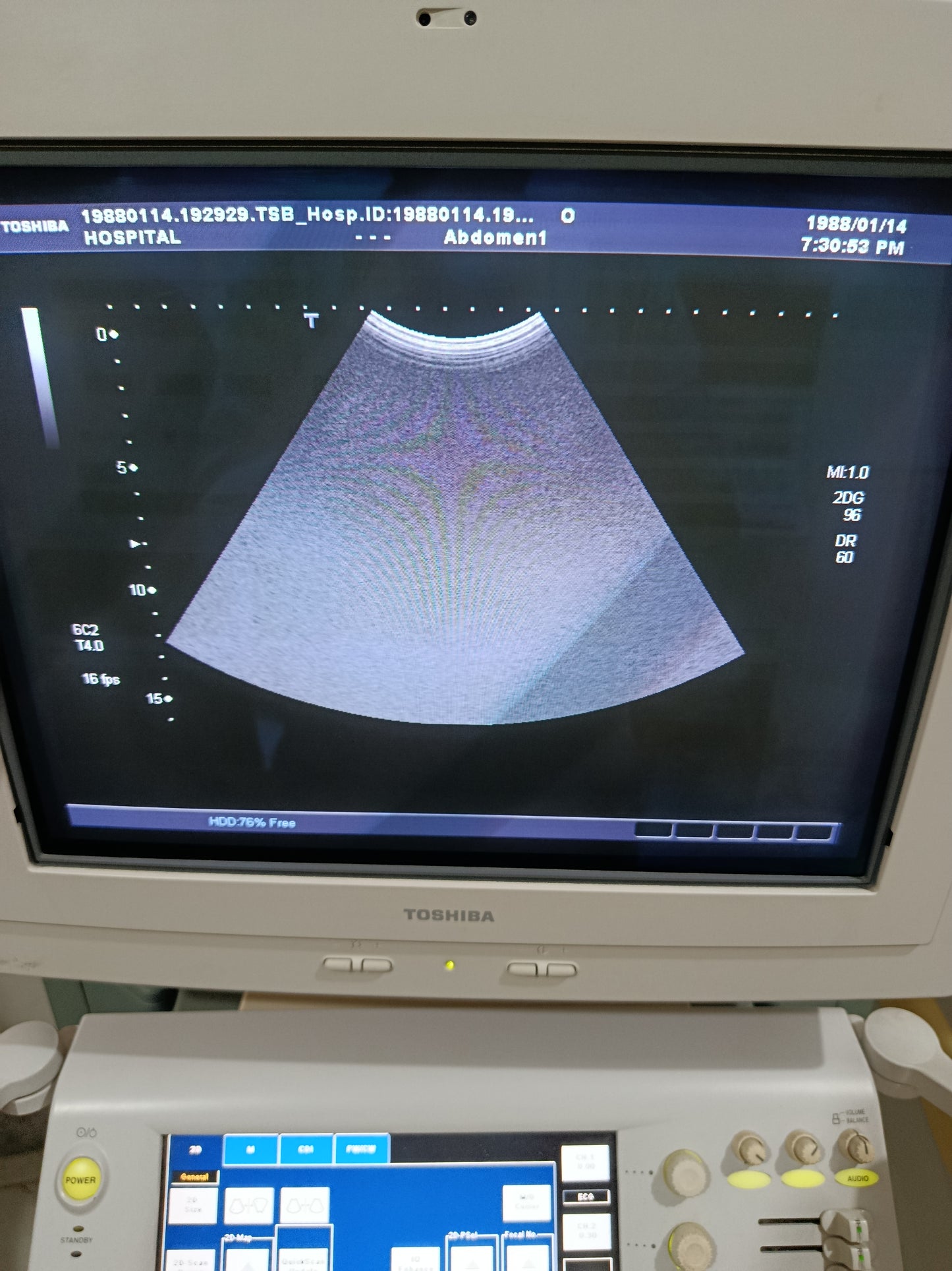 P.. Toshiba PVT-375AT Convex Probe