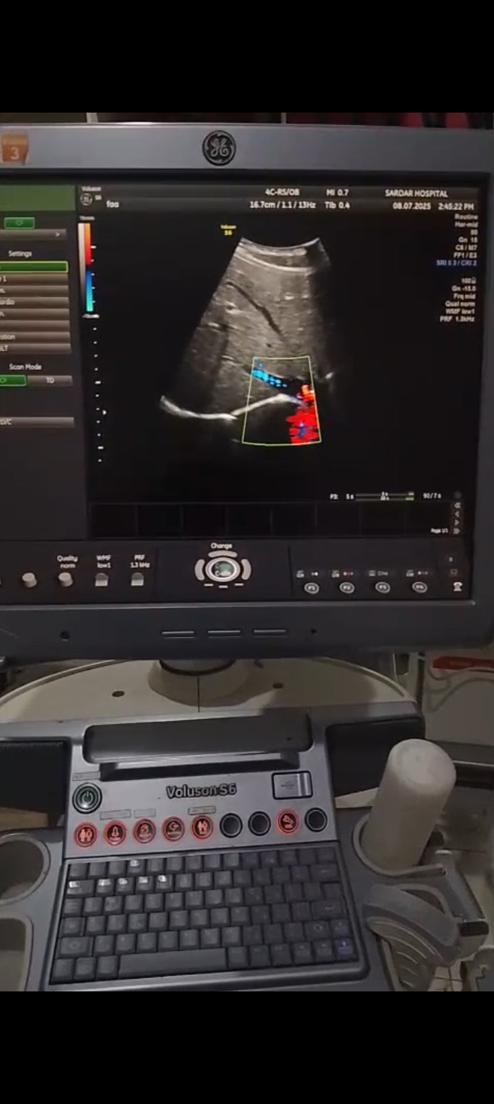 P..4c-Rs convex probe (1)