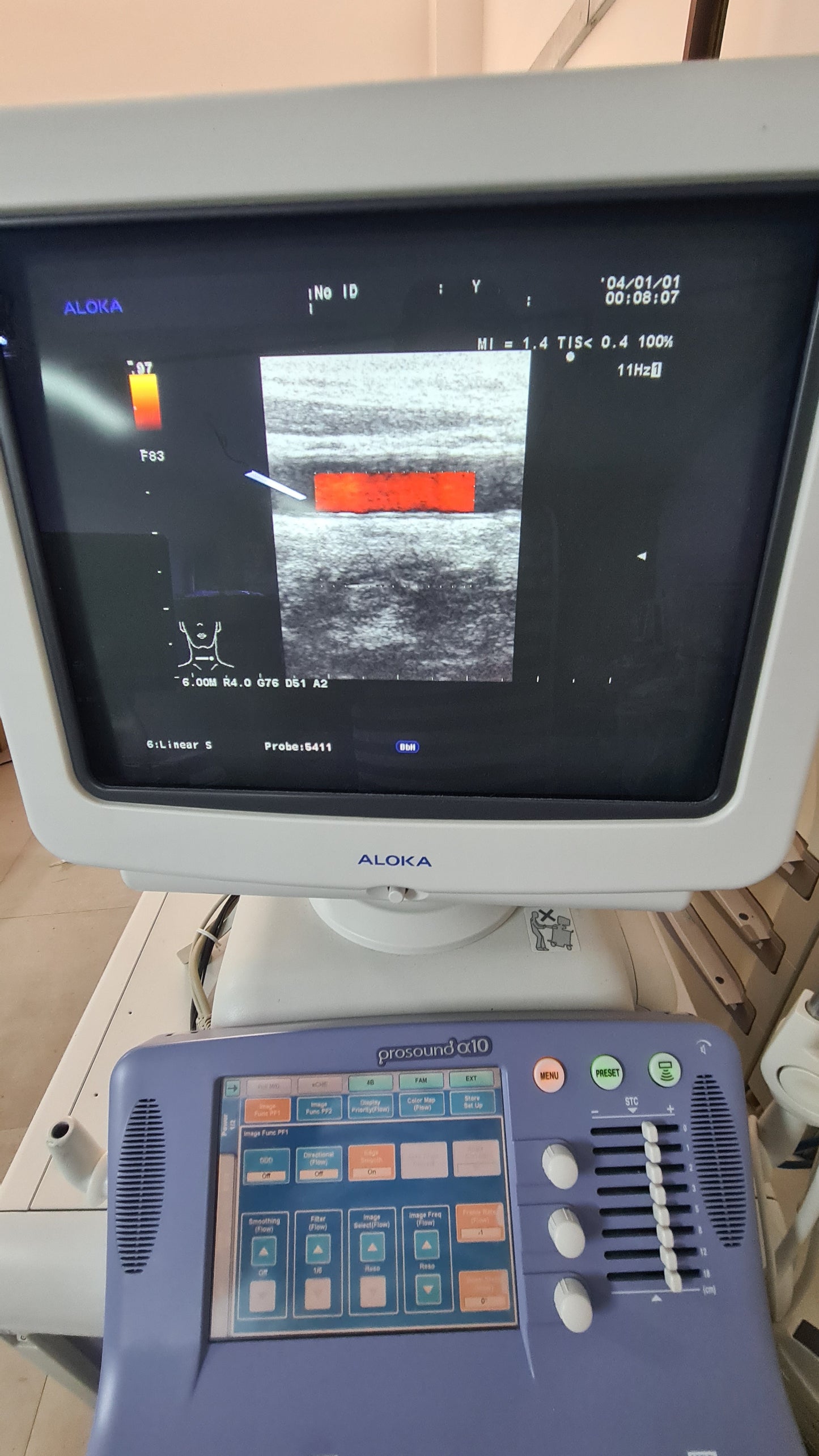 Aloka UST-5411 PROB L SN. M00355 checked
