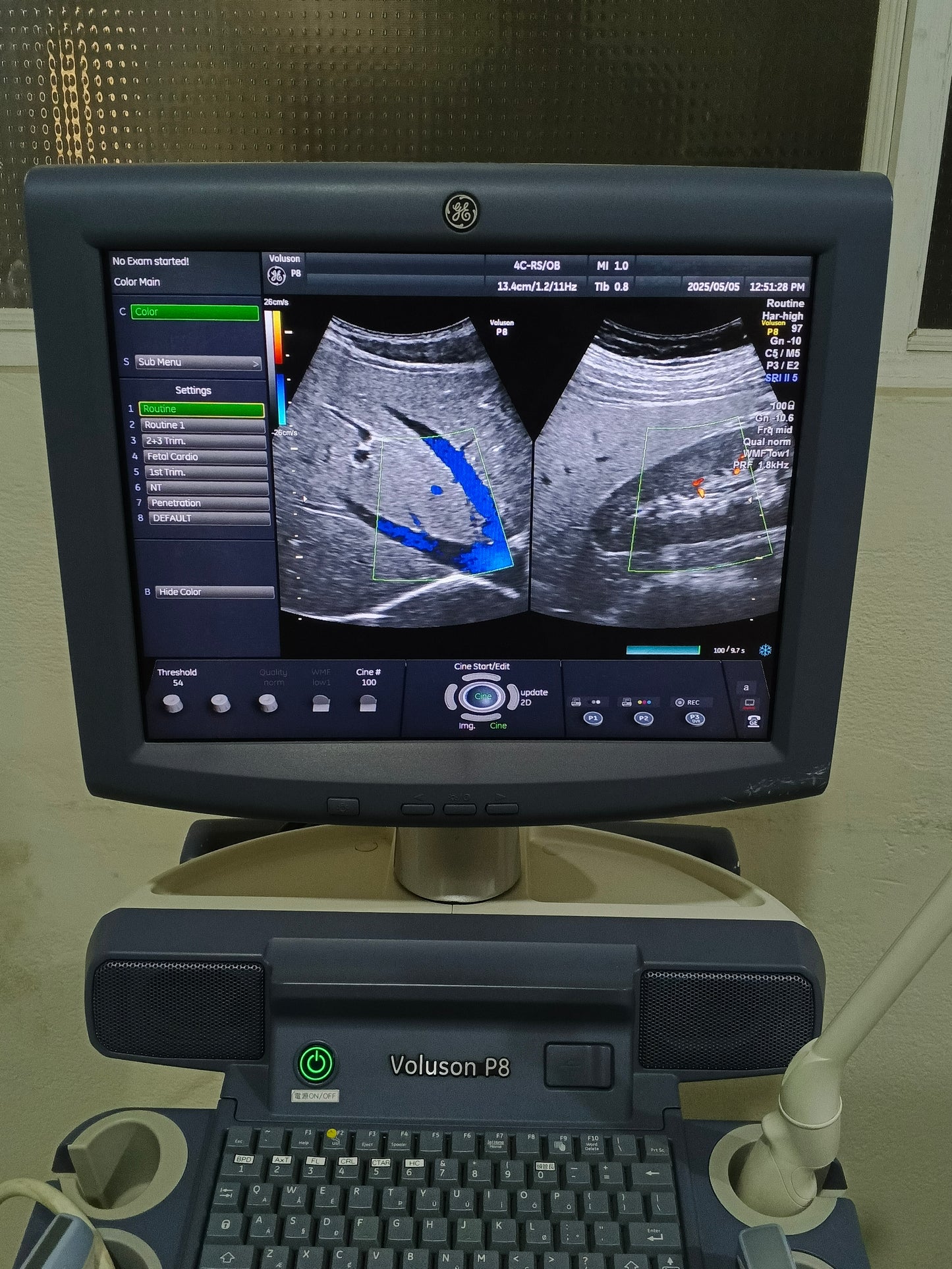 ...Ge voluson P8 convex probe