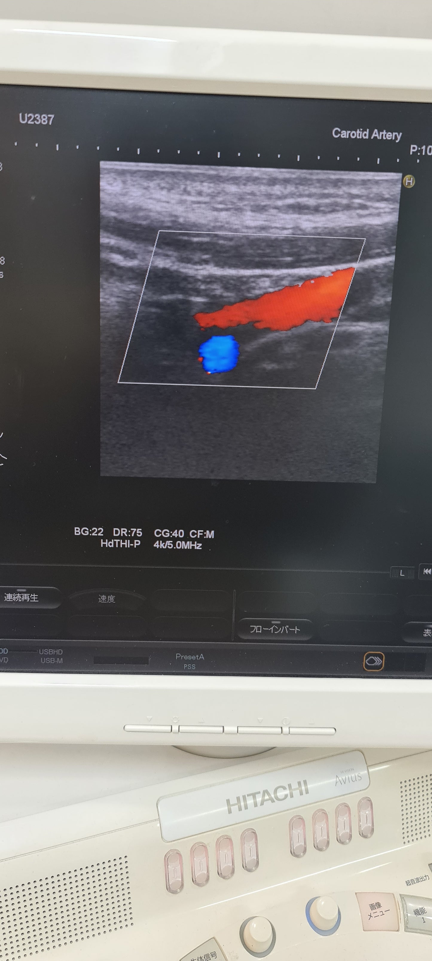 ..Hitachi EUP-L73S linear probe Checked