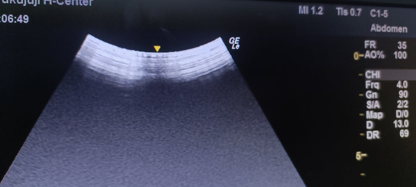 GE C1-5-RS 025 CHECKED NOT OK DXB