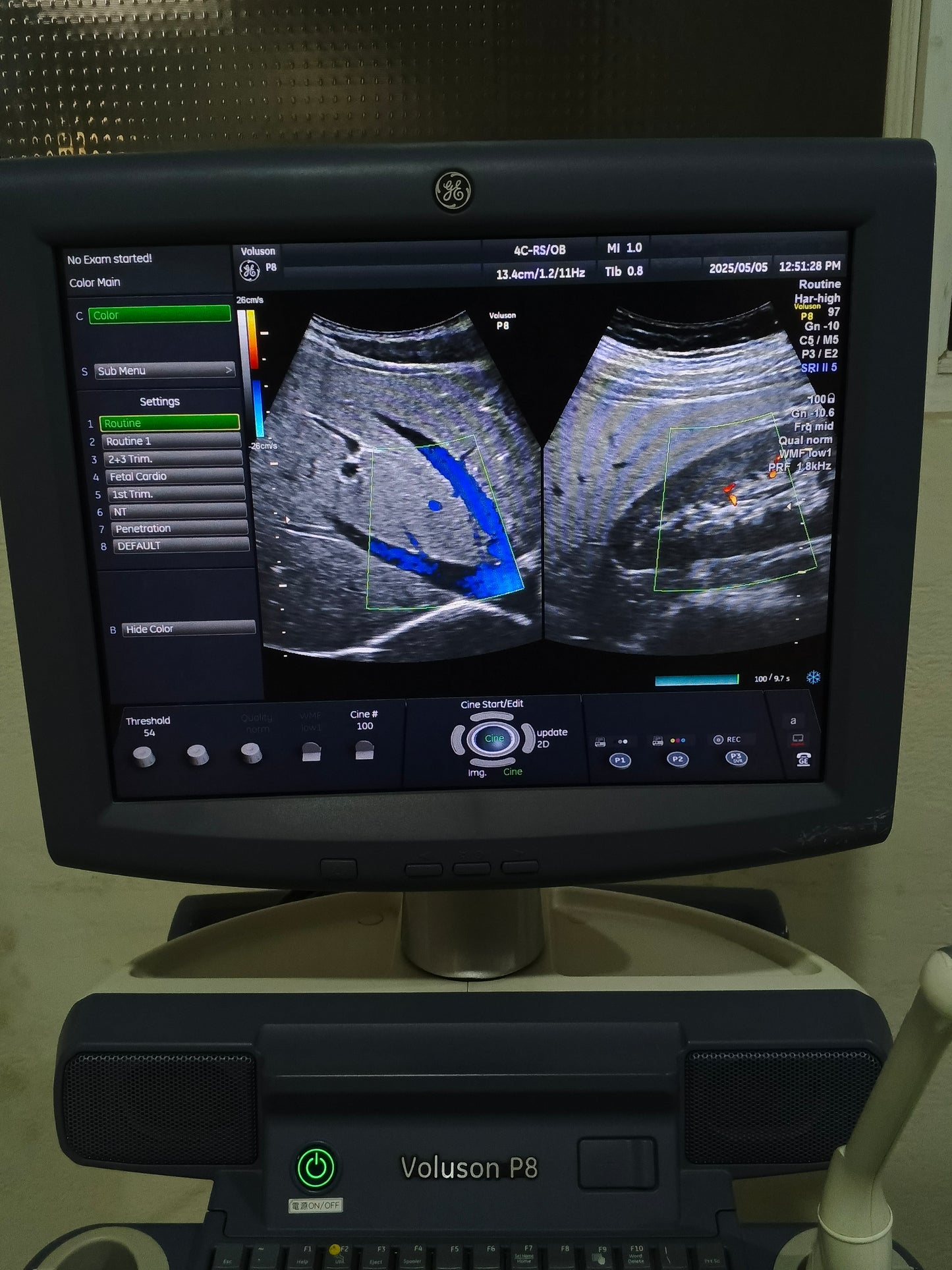 ...Ge voluson P8 convex 4C RS probe DXB