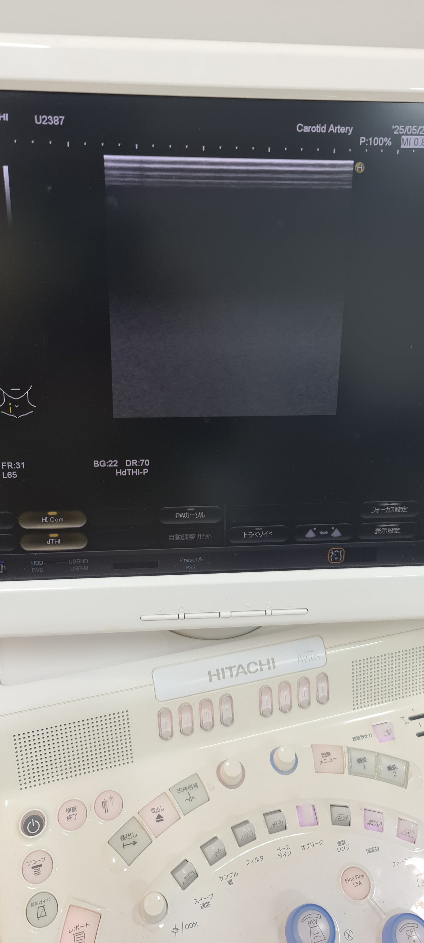 ..Hitachi EUP-L64 linear probe Checked DXB - Japan Medical Company LTD