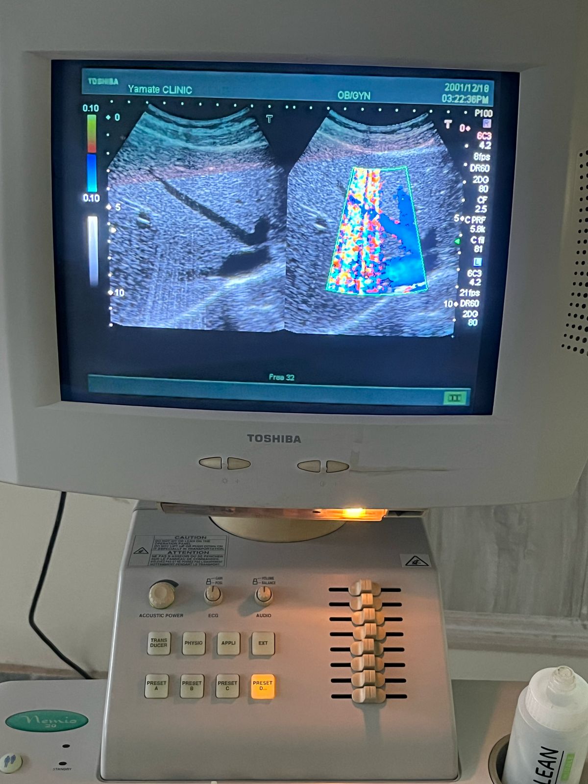 P...Toshiba PVM-375AT Convex Probe