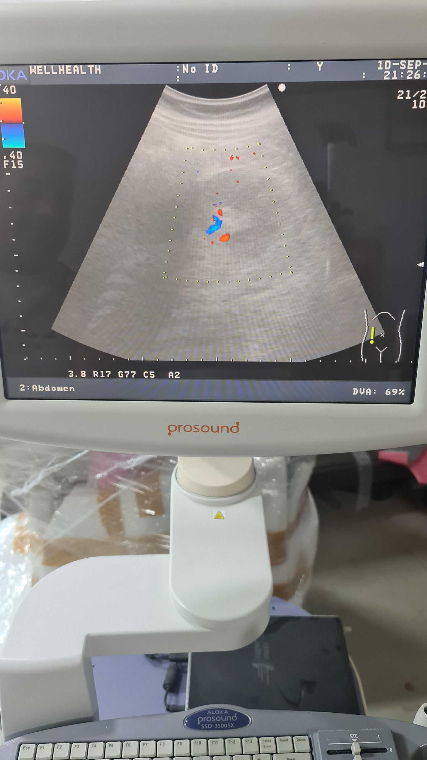 Z..Aloka UST-9123 Convex Probe checked S.No V0004230 dxb