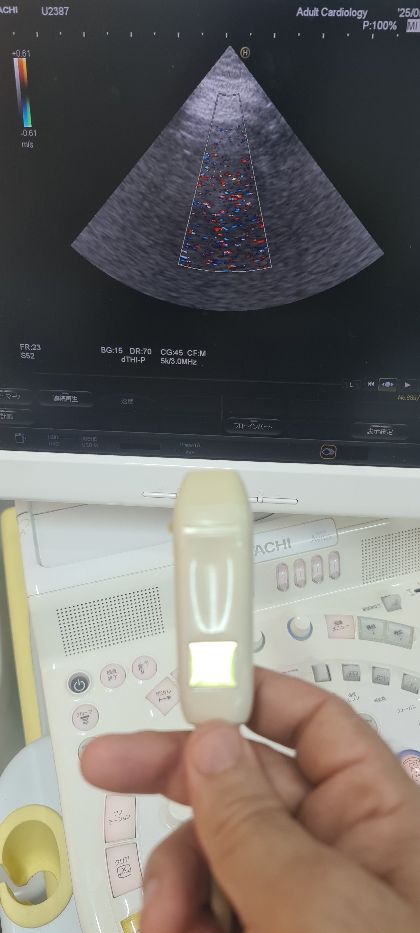 ..Hitachi EUP-S52 cardiac probe Checked DXB