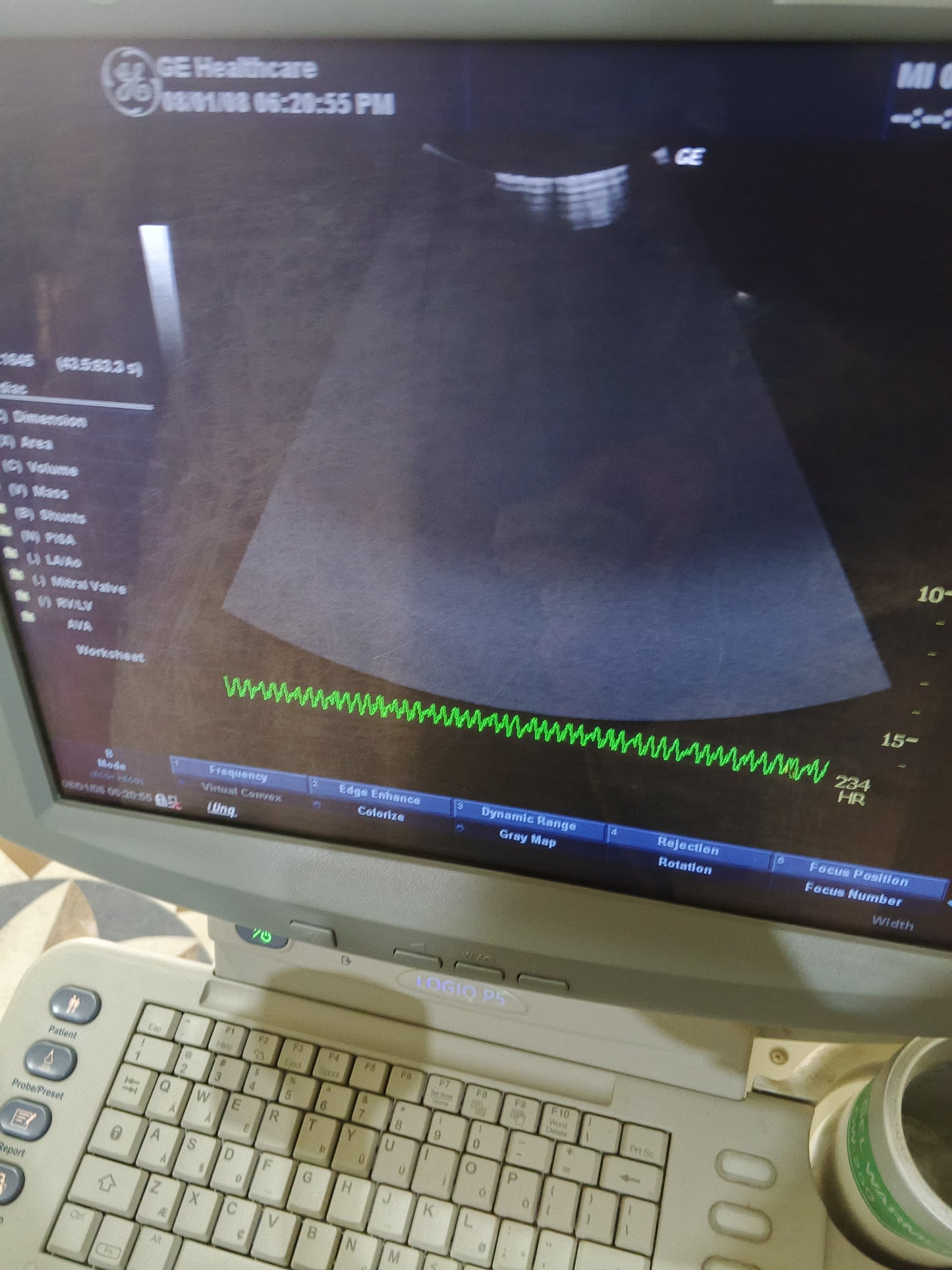 GE logiq p5 Convex probe
