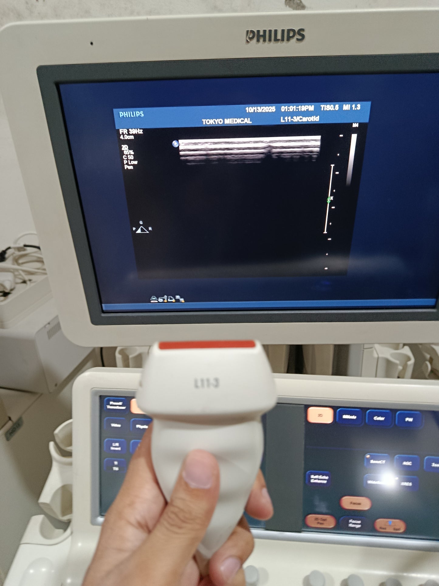 P.. Phillips L11-3 Linear Probe