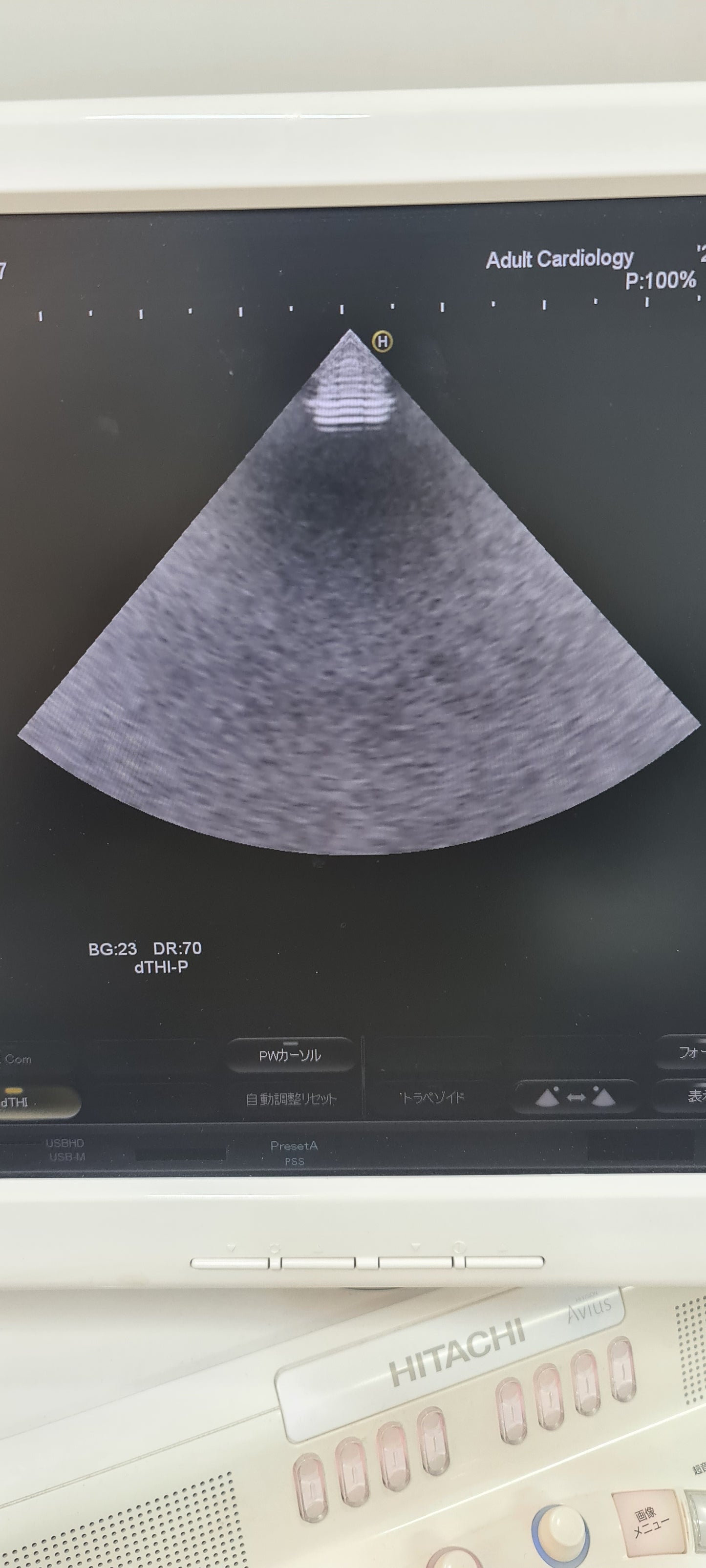 ..Hitachi EUP-S52 cardiac probe Checked DXB