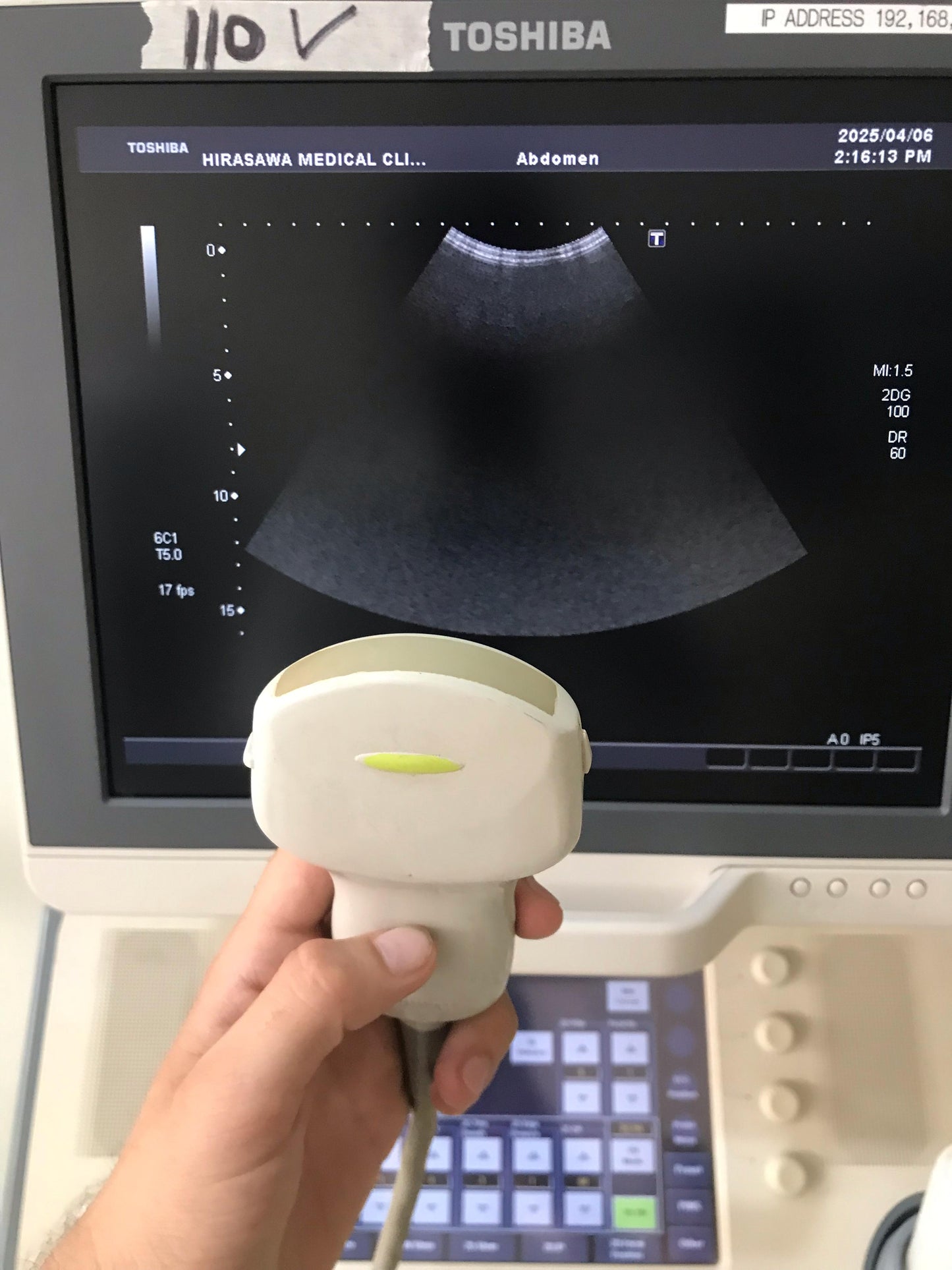 P..Toshiba PVT-375BT Convex Probe