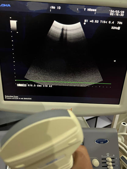 ..aloka UST-9123 convex probe - Japan Medical Company LTD