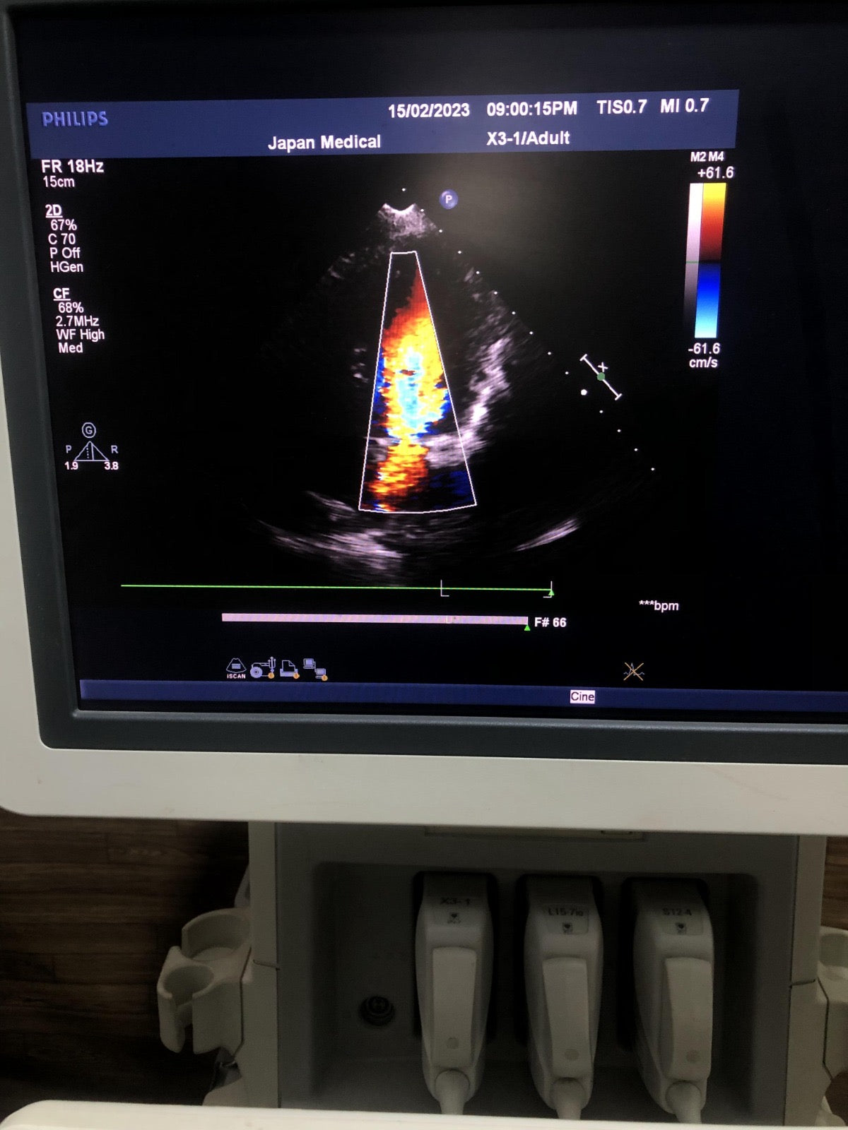 ..Philips X3-1 cardiac probe - Japan Medical Company LTD