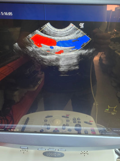 Dxb.. Ge e8c tvs probe