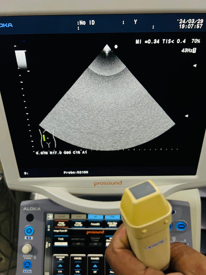..Aloka UST-52108 cardiac probe