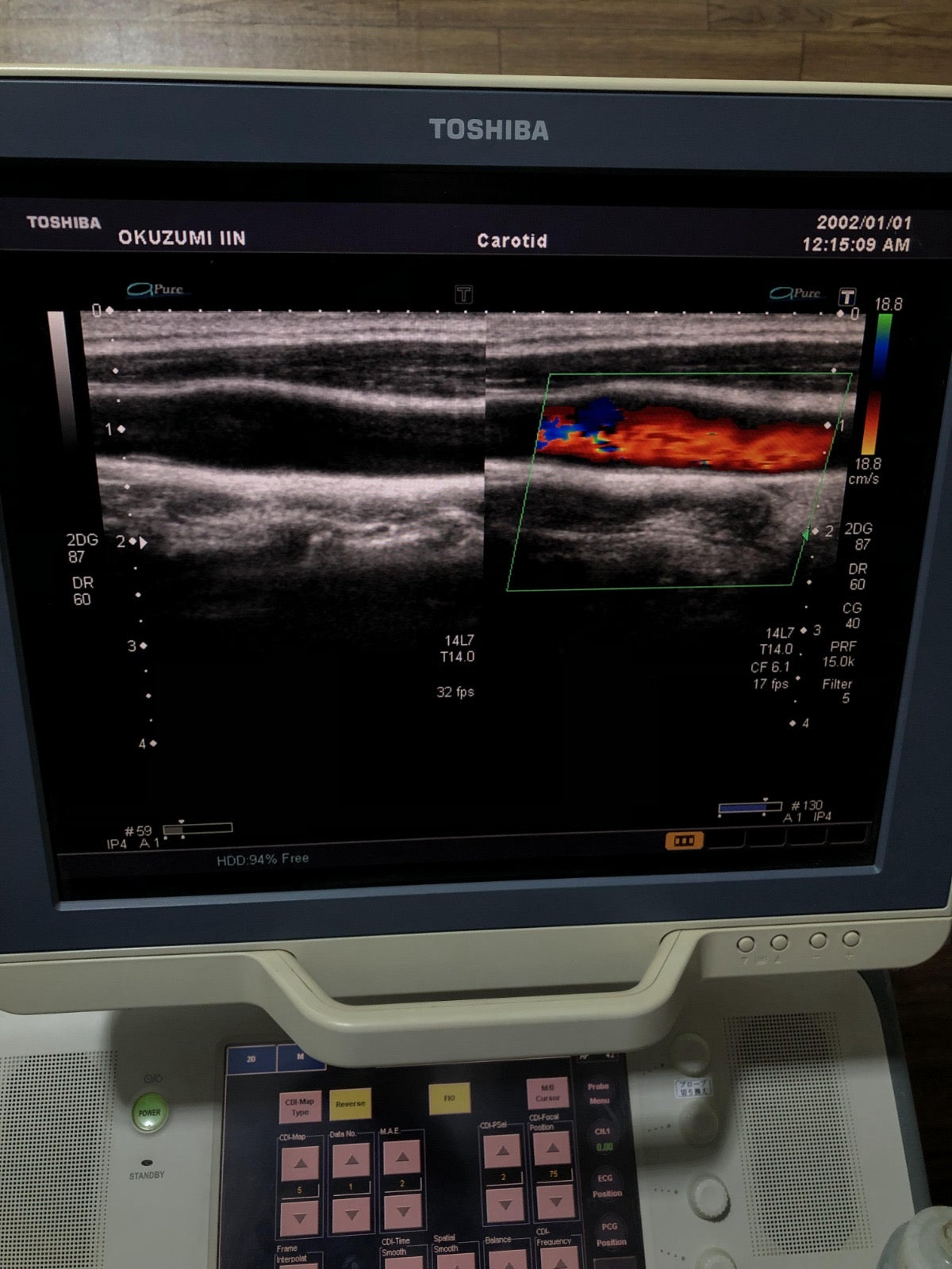 Toshiba PLT-1204AT linear probe - Japan Medical Company LTD