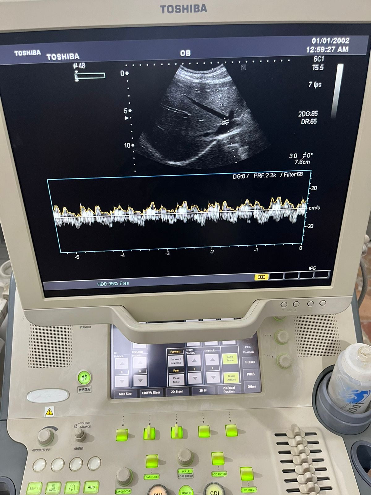 Toshiba Xario prime with convex linear probe