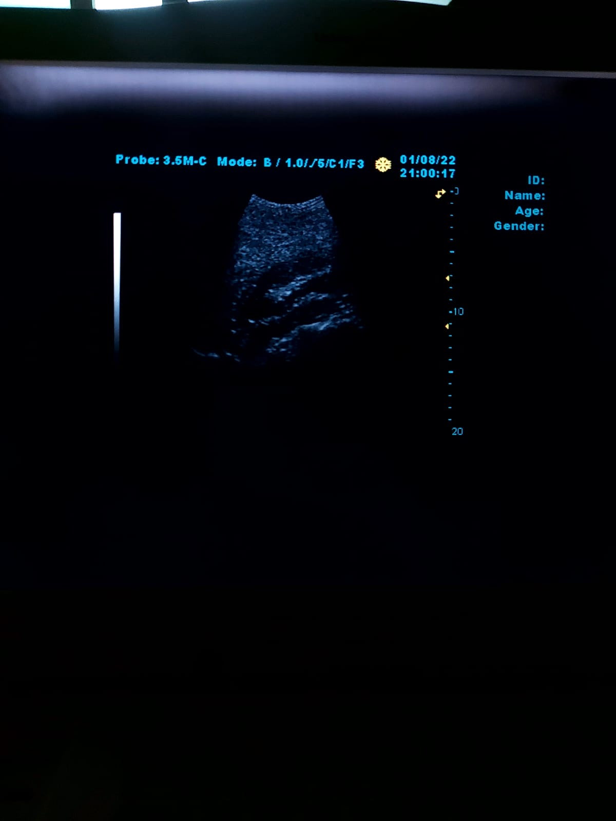 B..Linkton gray scale ultrasound machine, china used with convex probe