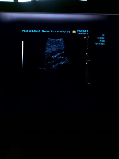 B..Linkton gray scale ultrasound machine, china used with convex probe