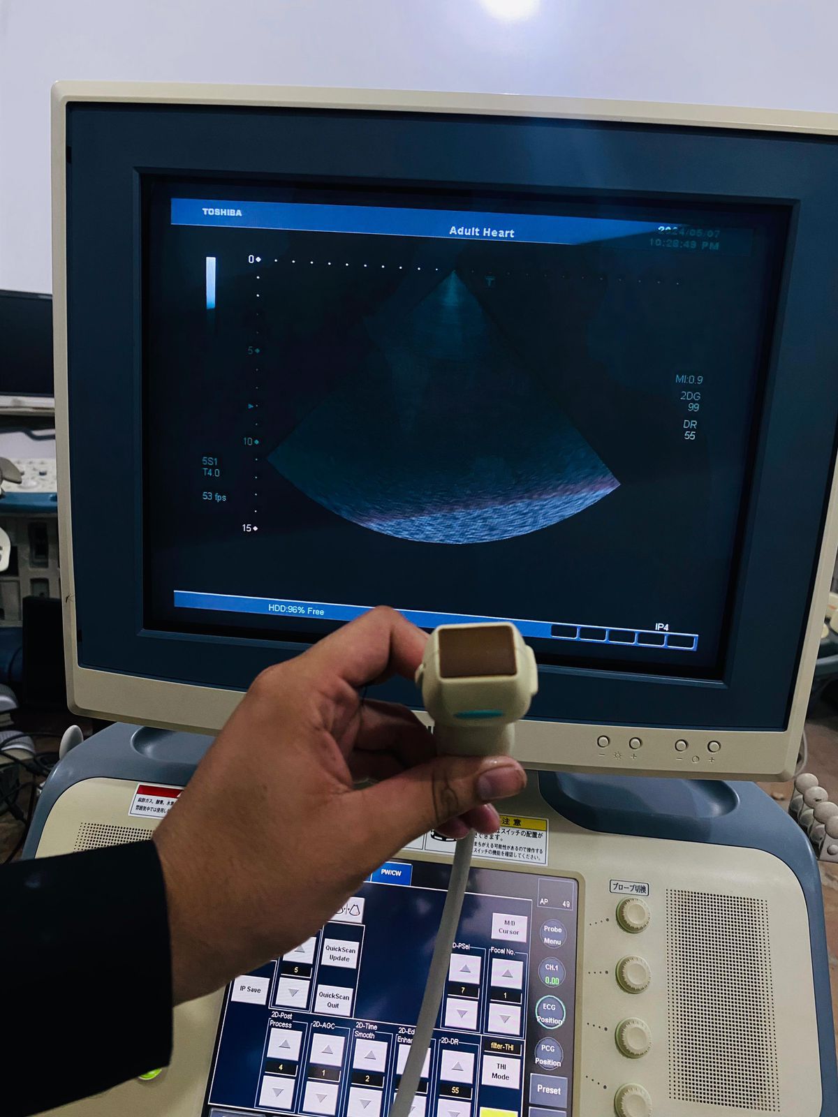 Toshiba Xario prime CRT with adult cardiac probe