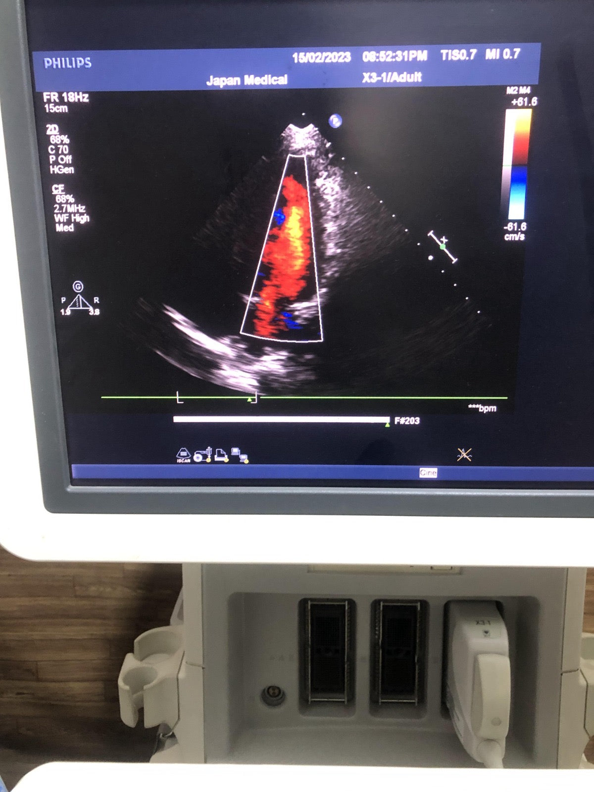 ..Philips X3-1 cardiac probe - Japan Medical Company LTD