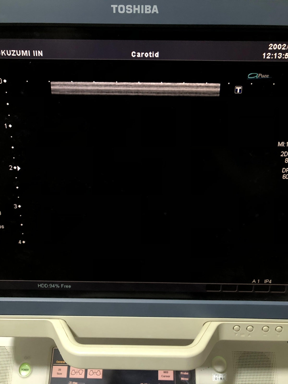 Toshiba PLT-1204AT linear probe - Japan Medical Company LTD