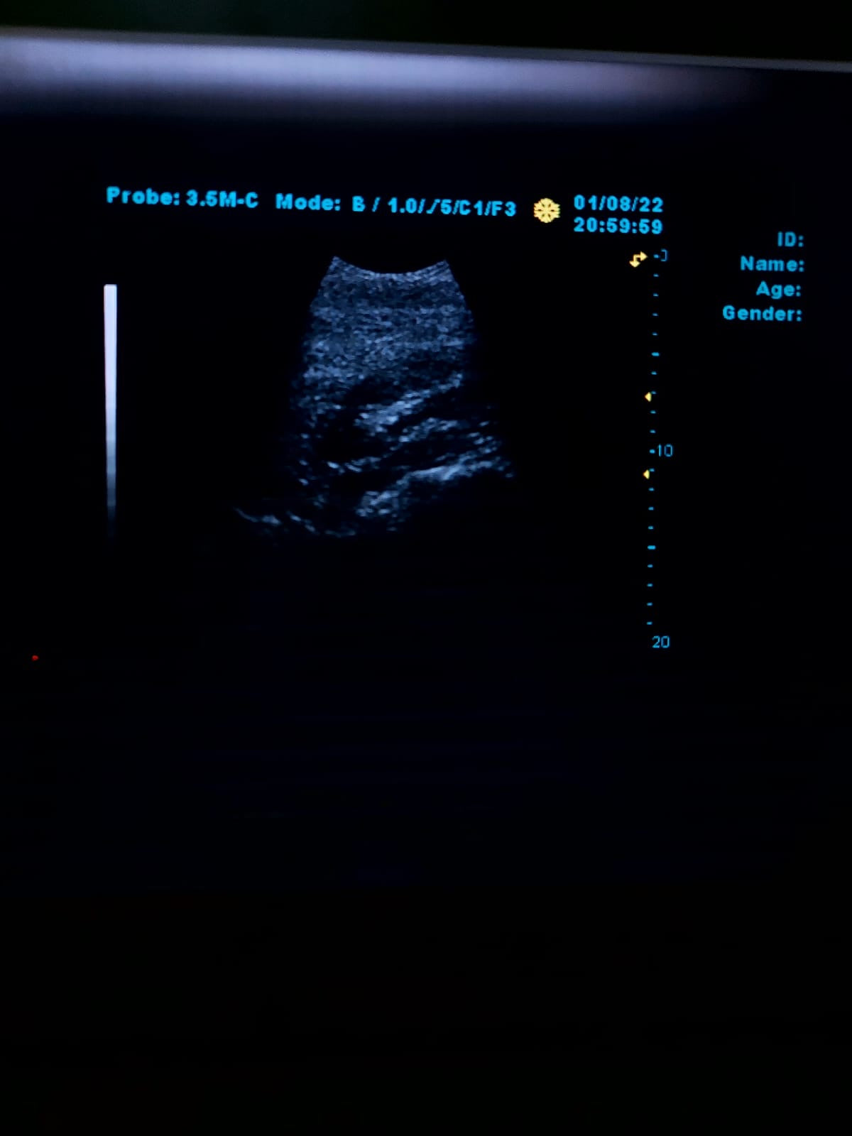 B..Linkton gray scale ultrasound machine, china used with convex probe