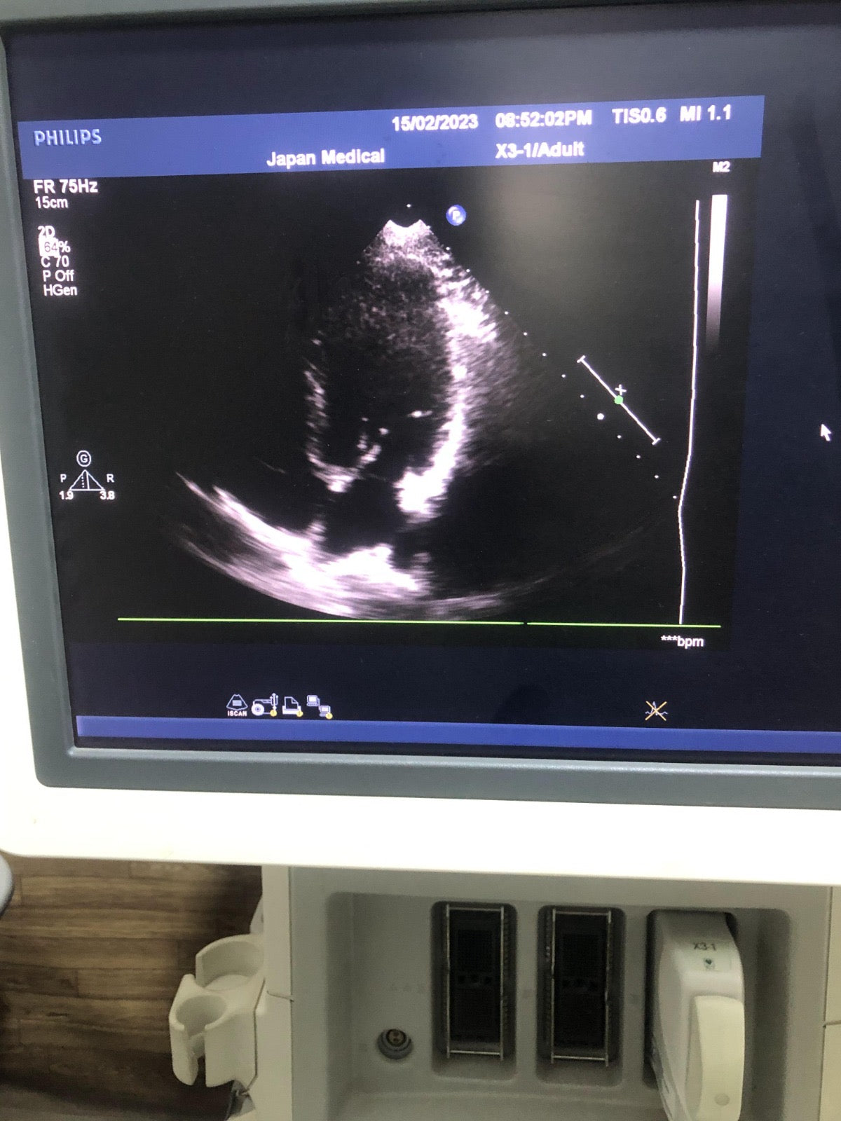 ..Philips X3-1 cardiac probe - Japan Medical Company LTD