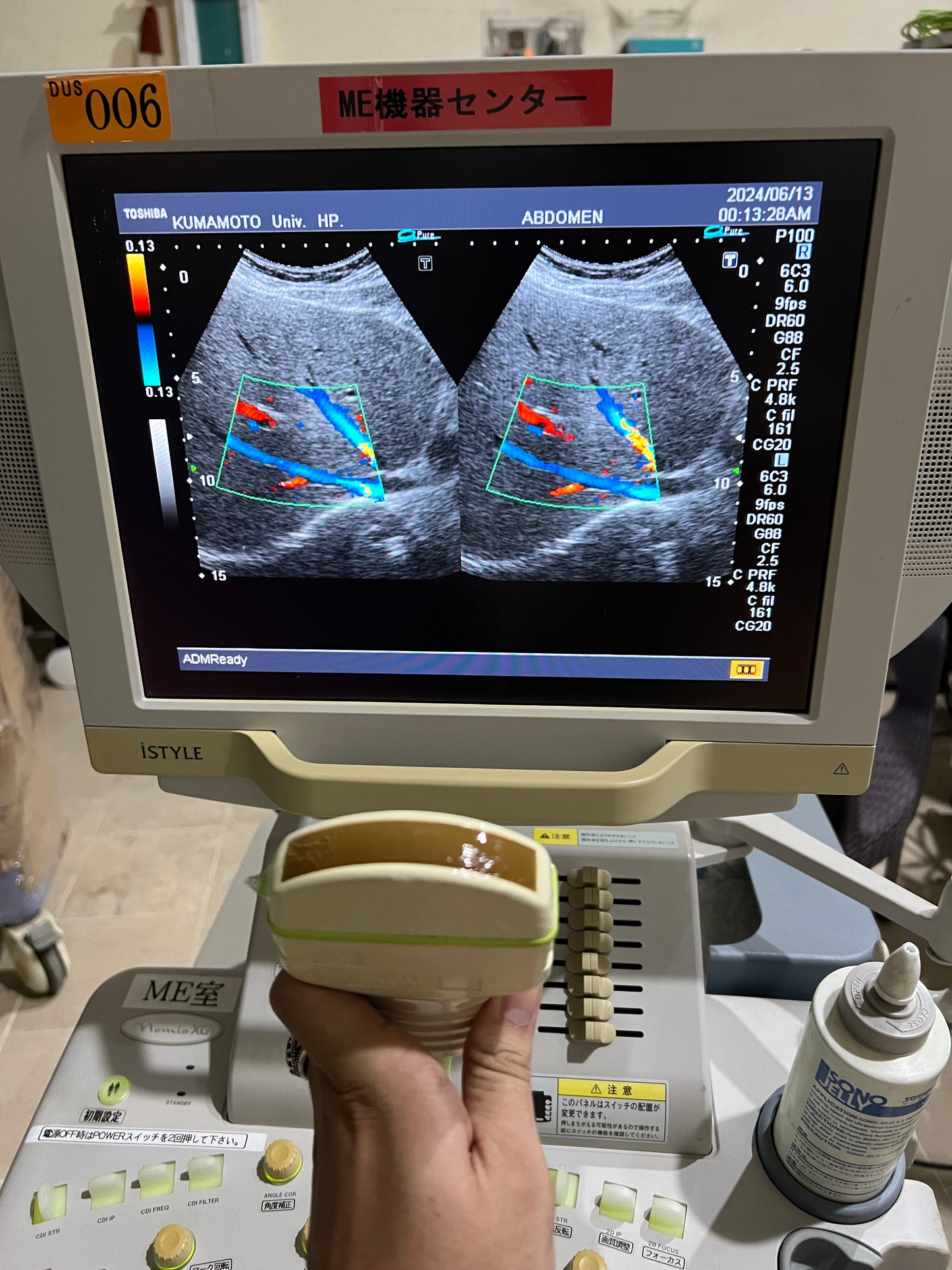 ..Toshiba PVM-375AT convex probe