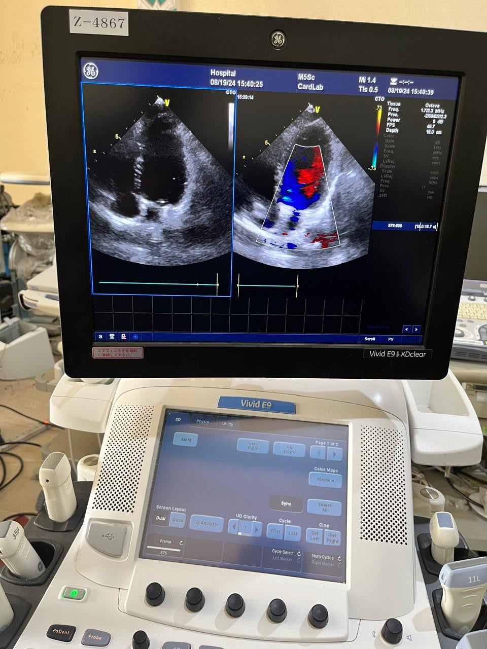 ..Ge M5Sc-D Cardiac Probe