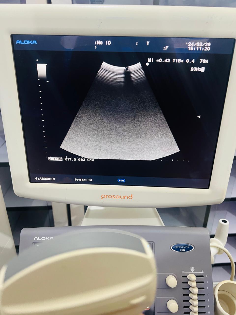 ..aloka UST-9123 convex probe - Japan Medical Company LTD