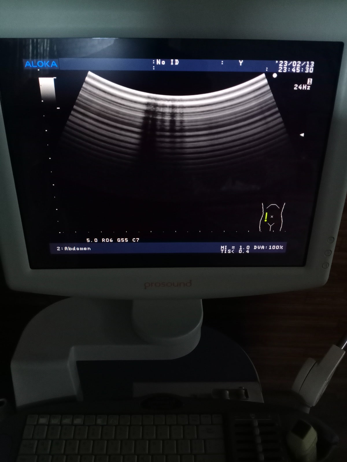 ..Hitachi UST-9123 convex probe - Japan Medical Company LTD