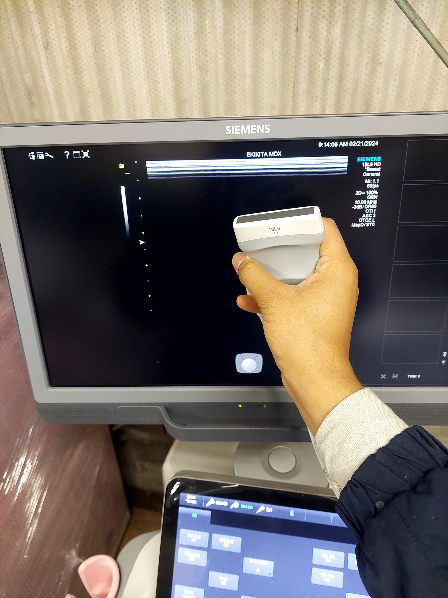 ACUSON S2000 ABVS Ultrasound System, YOM: 2019 HELX Evolution with Touch Control